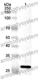 Anti-GLUD1 Polyclonal Antibody