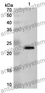 Anti-DHFR Polyclonal Antibody