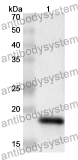 Anti-Human MT-CO2 Polyclonal Antibody