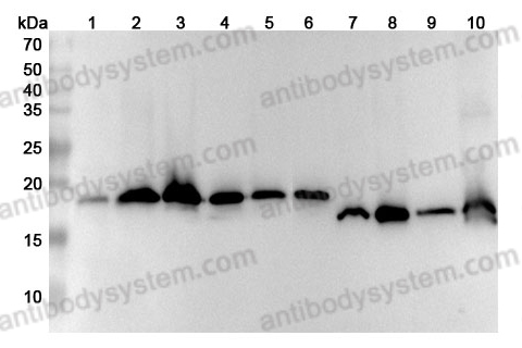 Anti-SOD1 Polyclonal Antibody