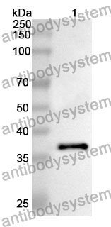 Anti-F8 Polyclonal Antibody