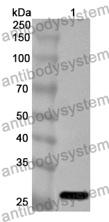 Anti-Human F8/Coagulation factor VIII Polyclonal Antibody