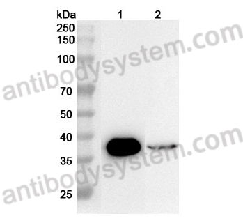 Anti-OTC Polyclonal Antibody