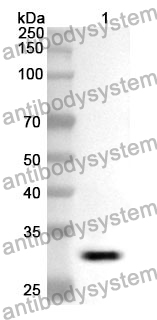 Anti-F13A1 Polyclonal Antibody