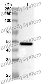 Anti-GOT2 Polyclonal Antibody