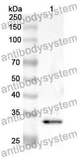 Anti-F2 Polyclonal Antibody