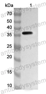 Anti-F2/Prothrombin Polyclonal Antibody