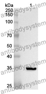 Anti-F12 Polyclonal Antibody