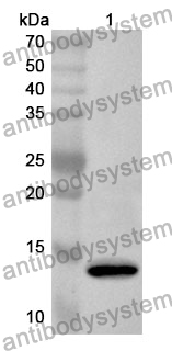 Anti-REN Polyclonal Antibody