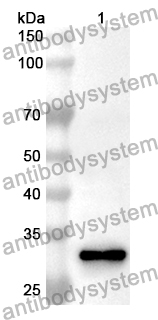 Anti-CA2 Polyclonal Antibody