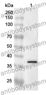 Anti-OAS1 Polyclonal Antibody