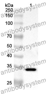 Anti-SPINK1 Polyclonal Antibody