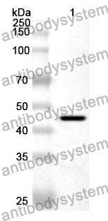 Anti-SERPINA3 Polyclonal Antibody