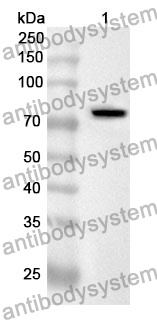 Anti-AGT Polyclonal Antibody