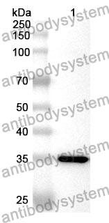 Anti-C5 Polyclonal Antibody