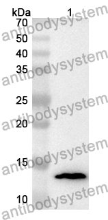 Anti-Human C5 Polyclonal Antibody