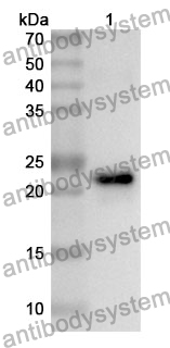 Anti-TIMP1 Polyclonal Antibody