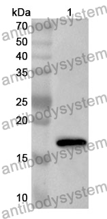 Anti-CST4 Polyclonal Antibody