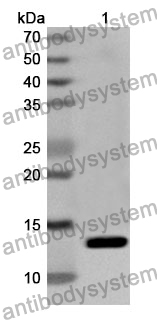 Anti-CSTA Polyclonal Antibody