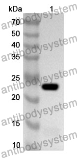 Anti-Human NRAS Polyclonal Antibody