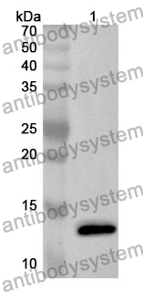 Anti-HRAS Polyclonal Antibody