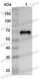 Anti-Human LDLR Polyclonal Antibody