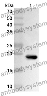 Anti-EGF Polyclonal Antibody