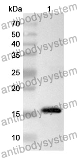 Anti-TSHB Polyclonal Antibody