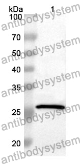 Anti-PRL Polyclonal Antibody