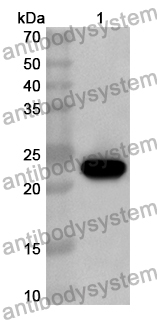 Anti-Human GH1 Polyclonal Antibody