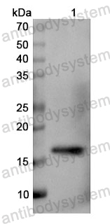 Anti-Human PTH Polyclonal Antibody