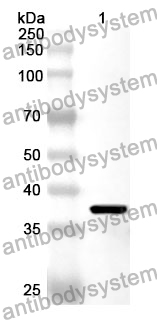 Anti-GHRH Polyclonal Antibody