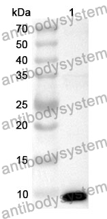 Anti-IGF2 Polyclonal Antibody