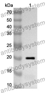 Anti-Human LTA Polyclonal Antibody