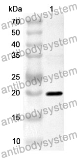 Anti-TNFa/TNF-alpha Polyclonal Antibody