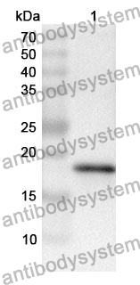 Anti-IFNG/IFN-gamma Polyclonal Antibody