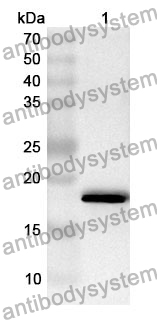 Anti-IL1B/IL1F2 Polyclonal Antibody