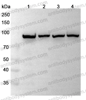 Anti-PIGR Polyclonal Antibody