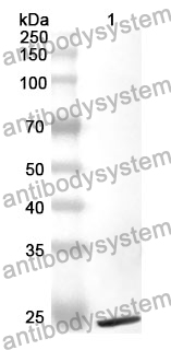 Anti-HLA-DRA Polyclonal Antibody