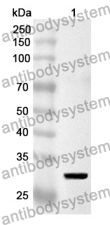 Anti-HLA-DRB1 Polyclonal Antibody