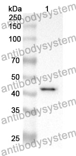 Anti-HBD Polyclonal Antibody