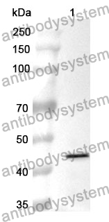 Anti-MB Polyclonal Antibody