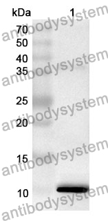 Anti-COL2A1 Polyclonal Antibody