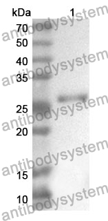 Anti-COL4A1 Polyclonal Antibody