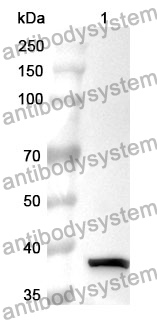 Anti-KRT6A Polyclonal Antibody