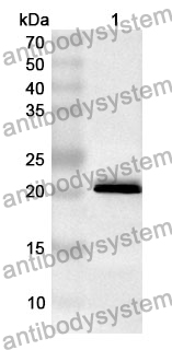 Anti-APOA2 Polyclonal Antibody