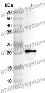 Anti-APOC3 Polyclonal Antibody