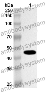 Anti-FGB/Fibrinogen beta Polyclonal Antibody