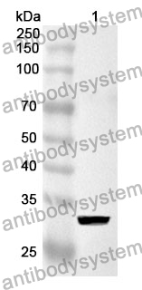 Anti-FGG Polyclonal Antibody