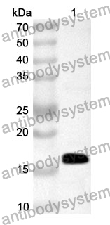 Anti-Human PMP2 Polyclonal Antibody